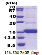 CD300A / CMRF35H (18-128, His-tag) Human Protein