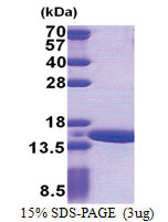 NATD1 (1-113, His-tag) Human Protein