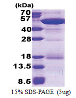 NCK2 (1-380, His-tag) Human Protein