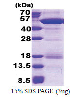 NCK2 (1-380, His-tag) Human Protein