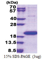 IL1F9 / IL1H1 (1-169, His-tag) Human Protein