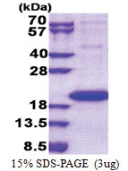 IL1F9 / IL1H1 (1-169, His-tag) Human Protein