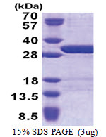 USP15 (1-235, His-tag) Human Protein