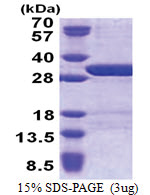 USP15 (1-235, His-tag) Human Protein