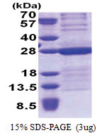 HMGB3 (1-180, His-tag) Human Protein