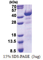 HHEX / PRH (1-270, His-tag) Human Protein