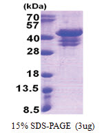 UFD1L (1-307, His-tag) Human Protein