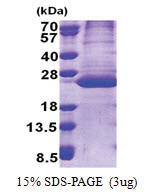 PPPDE2 (1-168, His-tag) Human Protein