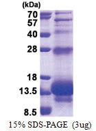 Elafin / PI3 (23-117, His-tag) Human Protein
