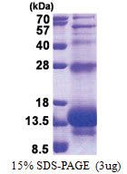Elafin / PI3 (23-117, His-tag) Human Protein