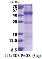 GIMAP6 (1-292, His-tag) Human Protein