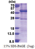 GIMAP6 (1-292, His-tag) Human Protein