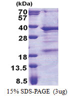 THAP3 (1-239, His-tag) Human Protein