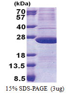 ATP synthase subunit d (1-161, His-tag) Human Protein