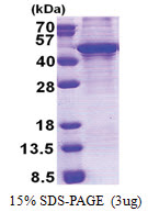 KLF3 (1-345, His-tag) Human Protein