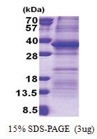 PSG5 (35-335, His-tag) Human Protein