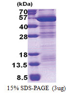 MAEA (1-396, His-tag) Human Protein