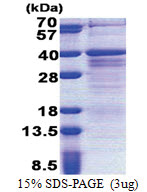 ZMAT3 (1-289, His-tag) Human Protein