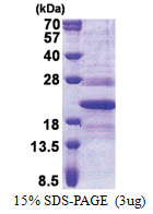 TMED10 / TMP21 (32-185, His-tag) Human Protein