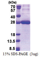 CEACAM21 (35-240, His-tag) Human Protein