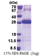 Trypsin-3 / PRSS3 (81-304, His-tag) Human Protein
