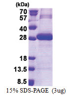 Trypsin-3 / PRSS3 (81-304, His-tag) Human Protein