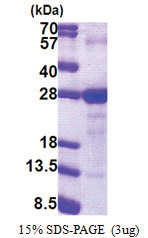 LY6G6F / C6orf21 (17-235, His-tag) Human Protein
