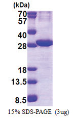 ATP1B2 (68-290, His-tag) Human Protein