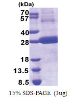 Cathepsin F (271-484, His-tag) Human Protein Cathepsin F (271-484, His-tag) Human Protein