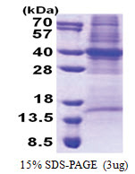 COPS6 (1-327, His-tag) Human Protein