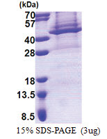 Apolipoprotein L4 / ApoL4 (1-348, His-tag) Human Protein Apolipoprotein L4 / ApoL4 (1-348, His-tag) Human Protein