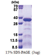 SPAG7 (1-227, His-tag) Human Protein SPAG7 (1-227, His-tag) Human Protein