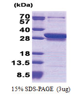 CCDC25 (1-208, His-tag) Human Protein