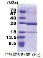 C19orf50 (1-176, His-tag) Human Protein