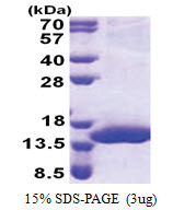 C17orf37 (1-112, His-tag) Human Protein