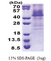 HOXC11 / HOX3H (1-304, His-tag) Human Protein