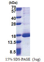 RPL30 (1-115, His-tag) Human Protein