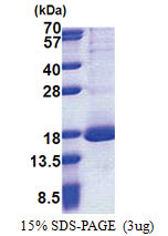 RPL30 (1-115, His-tag) Human Protein