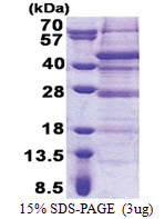 DERP6 (1-316, His-tag) Human Protein