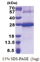 NDUFB9 (1-179, His-tag) Human Protein