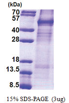Cyclin I (1-377, His-tag) Human Protein