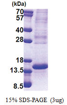 TP53AIP1 (1-124, His-tag) Human Protein