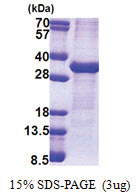 ATP1B1 (63-303, His-tag) Human Protein