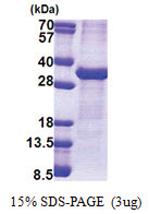 ATP1B1 (63-303, His-tag) Human Protein