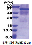 GPNMB / HGFIN (22-474, His-tag) Human Protein