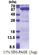 Protein phosphatase 1F / PPM1F (1-454, His-tag) Human Protein