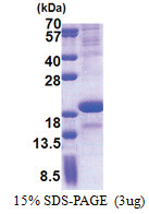 SCN3B (23-159, His-tag) Human Protein