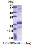 SCN3B (23-159, His-tag) Human Protein