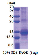 RNF7 (1-113, His-tag) Human Protein