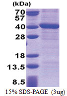 PPP4C (1-307, His-tag) Human Protein